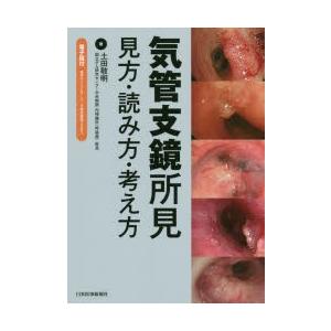 気管支鏡所見 見方・読み方・考え方｜guruguru