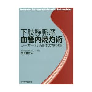 下肢静脈瘤血管内焼灼術 レーザーおよび高周波焼灼術｜guruguru