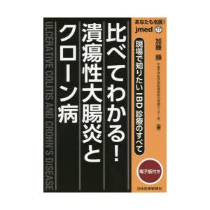 あなたも名医!比べてわかる!潰瘍性大腸炎とクローン病 現場で知りたいIBD診療のすべて