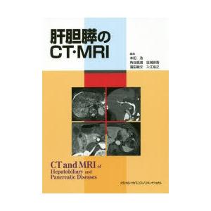 肝胆膵のCT・MRI｜guruguru