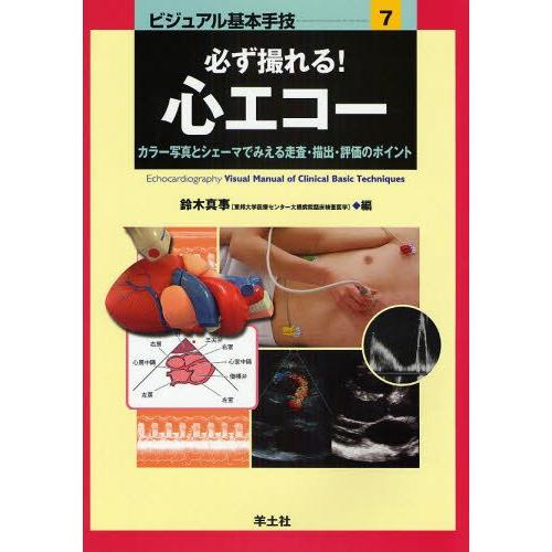 必ず撮れる!心エコー カラー写真とシェーマでみえる走査・描出・評価のポイント