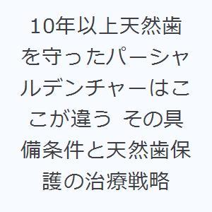 10年以上天然歯を守ったパーシャルデンチャーはここが違う その具備条件と天然歯保護の治療戦略