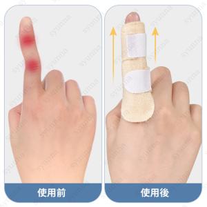 指サポーター (z89#) 日本国内当日発送 ...の詳細画像3