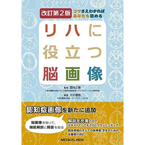 コツさえわかればあなたも読める リハに役立つ脳画像?改訂第2版