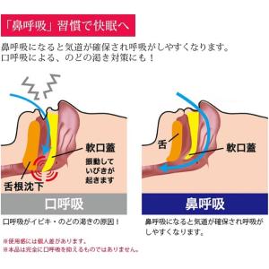 いびき防止ベルト いびき防止グッズ いびき防止...の詳細画像3