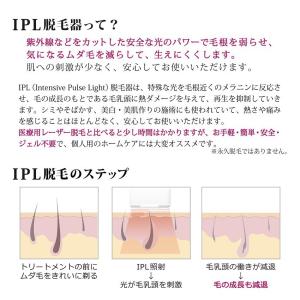 【送料無料】IPL光フラッシュ脱毛器 エピルミ...の詳細画像3