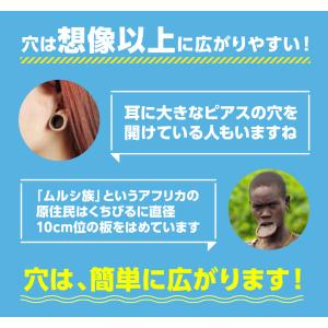 キトー君 DX 真性包茎矯正器具 グッズ 真性...の詳細画像3
