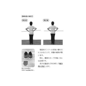 側弯トレーニングブック〜概説からエクササイズまで〜の詳細画像2