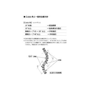 側弯トレーニングブック〜概説からエクササイズまで〜の詳細画像3