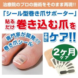 巻き爪シール 2ヶ月ケア（1ヶ月ケア×2個）巻き爪 対策 シール お悩み 巻爪 まきづめ 巻きつめ ツメ 彎曲爪 矯正｜heartdrop