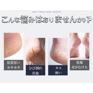 【5足セット】全面保湿 かかと・足裏ソックスつ...の詳細画像4
