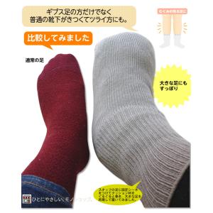浮腫みやギプスの方に。しめつけません特大靴下 ...の詳細画像2
