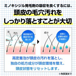 【初回限定】ヒックス スカルプシャンプー(HI...の詳細画像2