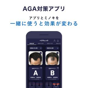 リアップX5チャージ 60mL【第1類医薬品】...の詳細画像5