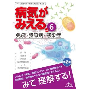 病気がみえる（６） 免疫・膠原病・感染症＜第2版＞　メディックメディア｜hkd-tsutayabooks