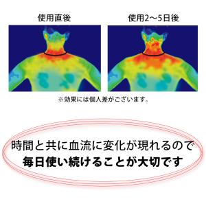 マグマックス ループ 200 MAGMAX L...の詳細画像4