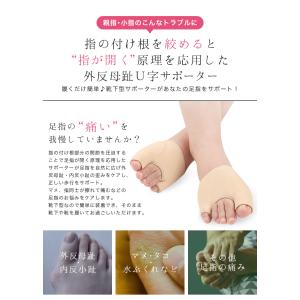 外反母趾 内反小趾 サポーター ソックス 両足...の詳細画像1