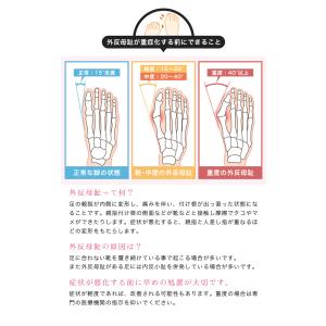 外反母趾 サポーター 親指 足指 シリコン調 ...の詳細画像2