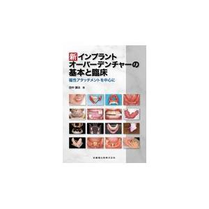 新インプラントオーバーデンチャーの基本と臨床 磁性アタッチメントを中心に 田中 譲治 著 京都 大垣書店オンライン 通販 Yahoo ショッピング