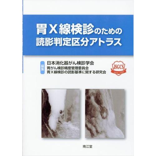 胃Ｘ線検診のための読影判定区分アトラス/日本消化器がん検診学