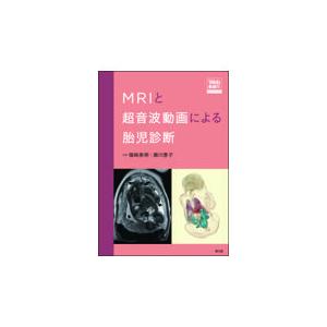 NIPT時代における 実践的 妊娠初期胎児超音波検査 NIPT時代における 実践的妊娠初期胎児超音波検査 | 中村 靖 |本 | 通販