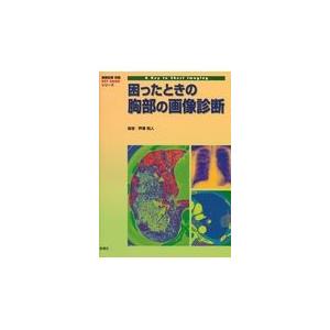 困ったときの胸部の画像診断/芦澤和人