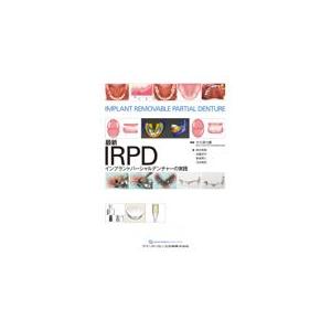 最新IRPD インプラントパーシャルデンチャーの実践/大久保力廣
