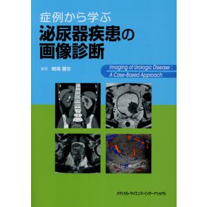 即戦力が身につく骨軟部の画像診断 : 有隣堂ヤフーショッピング店