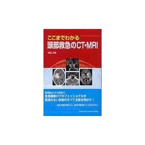 ここまでわかる頭部救急のCT MRI/井田正博