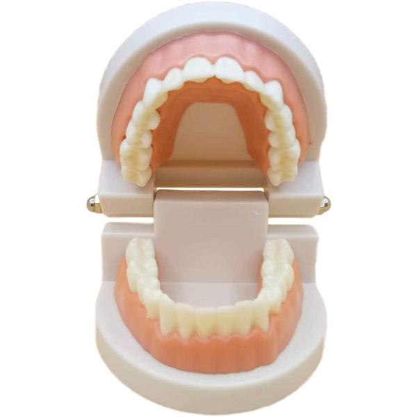 歯科模型 歯列模型 インプラント ブリッジ 差し歯 歯医者 研究 説明 教材 学習用(小型・ピンク)