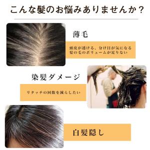 ヘアピース 人毛100% 頭頂部 ウィッグ 自...の詳細画像2