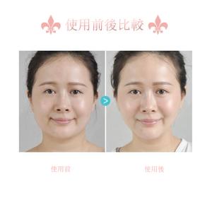 美顔ローラー 3D リフトアップ ほうれい線 ...の詳細画像5