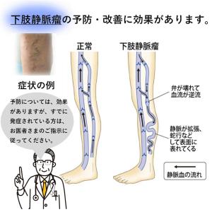 ふくらはぎサポーター 着圧ソックス 美脚 むく...の詳細画像3