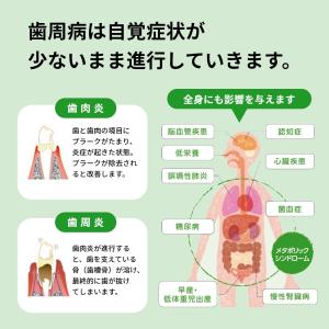 歯ブラシ ジーシー GC ルシェロ ピセラ P...の詳細画像3