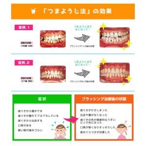 歯ブラシ V7 ブイセブン つまようじ法 レギ...の詳細画像1