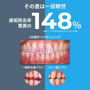 歯ブラシ KISS YOU キスユー イオン歯...の詳細画像3