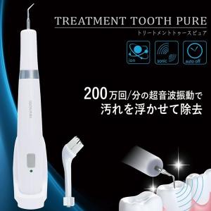 超音波振動 200万回 トゥーストリートメント 手磨きで落とせない