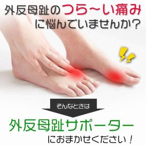 クッション付き 外反母趾 サポーター 2個組 ...の詳細画像1