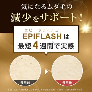 脱毛器 IPL 光美容器 VIO対応 全身対応...の詳細画像3