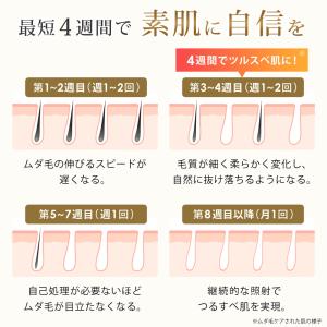 脱毛器 IPL 光美容器 VIO対応 全身対応...の詳細画像4