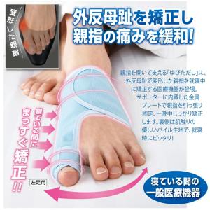 夜用メディカルゆびただし 両足セット 外反母趾...の詳細画像1
