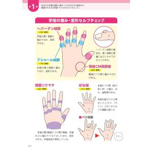 大学教授・関節症の名医が教える 運動を頑張らな...の詳細画像2
