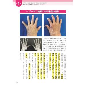 大学教授・関節症の名医が教える 運動を頑張らな...の詳細画像4