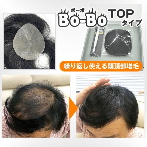 Bo-Bo (TOPタイプ) 部分かつら　増毛　BoBo　ボーボ　頭頂部　天頂部　メンズウィッグ　薄...