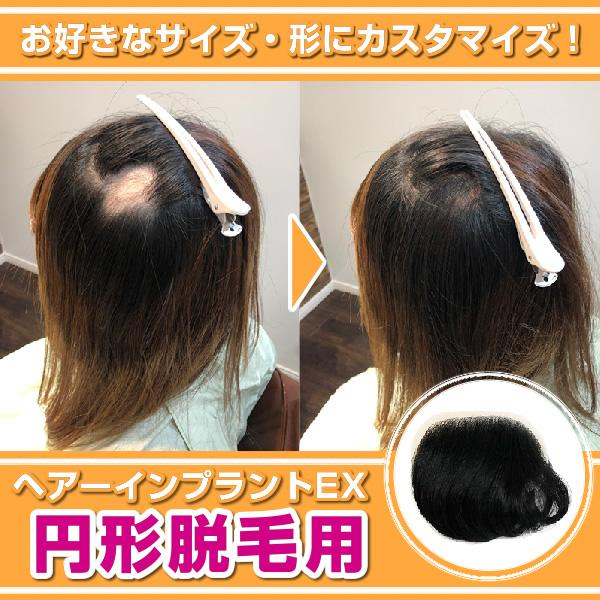 部分ウィッグ　頭皮一体増毛 ヘアーインプラントEX　円形脱毛用　※装着にはテープかシリコンが必要です