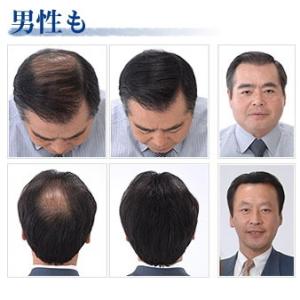 【SALE中7/31まで】増毛パウダー ふりか...の詳細画像4