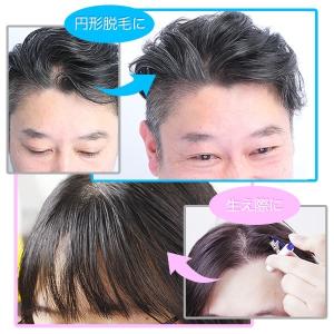 【全品10%中9/17まで】かつら ウィッグ ...の詳細画像5