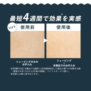[ポイント15倍]光美容器 美顔器 ミコラ セ...の詳細画像4