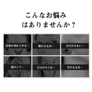 美顔ローラー EMS リフトアップ効果 母の日...の詳細画像3