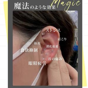耳つぼシール 粒タイプ 100粒 金属アレルギ...の詳細画像3